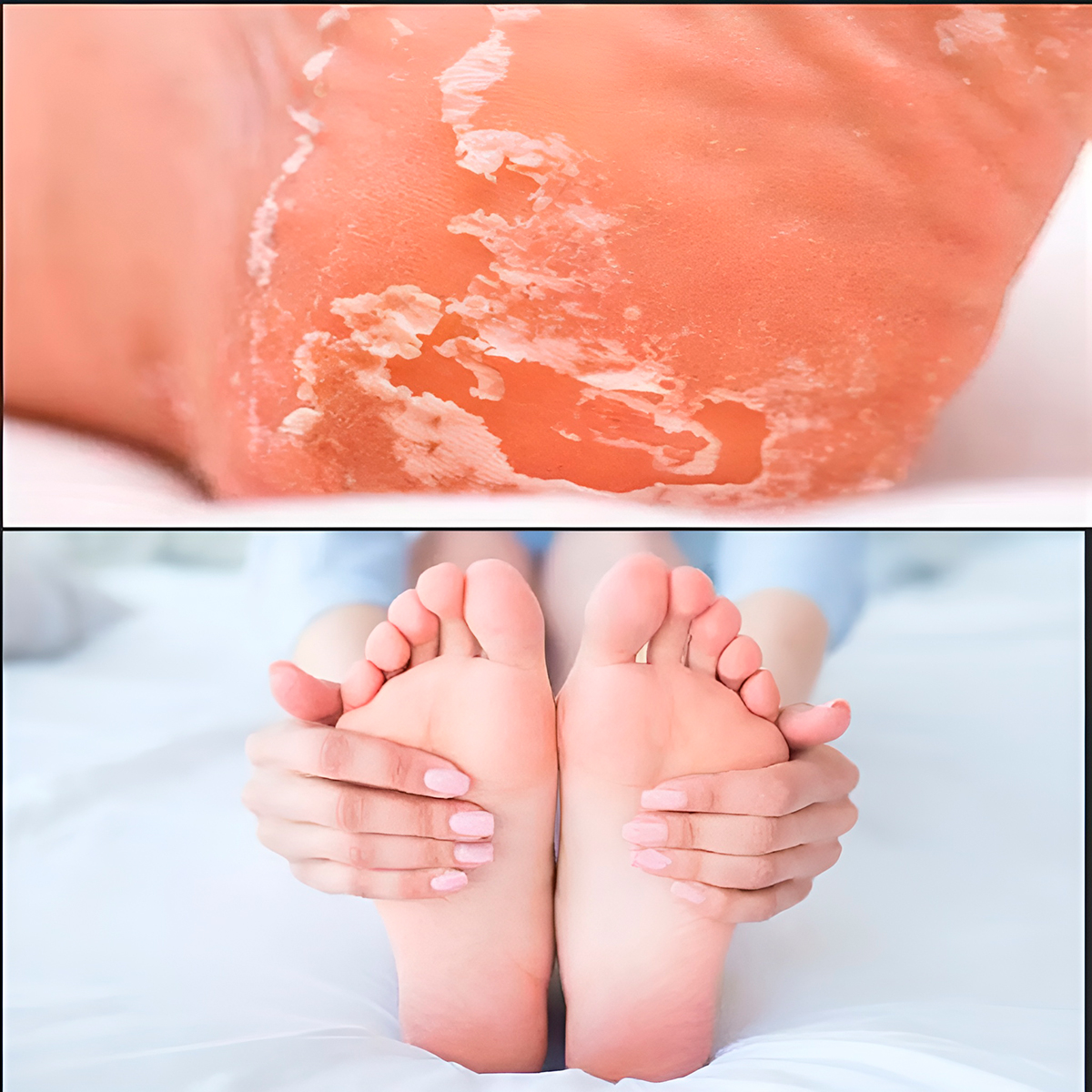 Máscara Esfoliante Pé Tratamento Aloe Vera Nutritivo Hidratante - Imagem 3